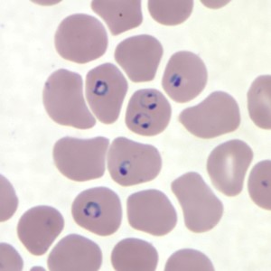 . Human red blood cells infected with P. falciparum