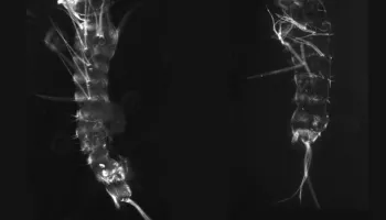 Mosquitoes Lost an Essential Gene with No Ill Effects