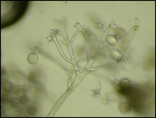 Fig. 2. Sporangia of impatiens downy mildew. Image kindly provided by Dr. Rane. 