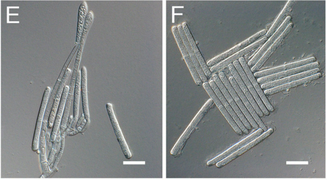 Fig. 3.  Conidia (spores) of the fungal pathogen Calonectria pseudonaviculata found to be responsible for Sarcococca blight. Image from Malapi-Wight et al. (2016)